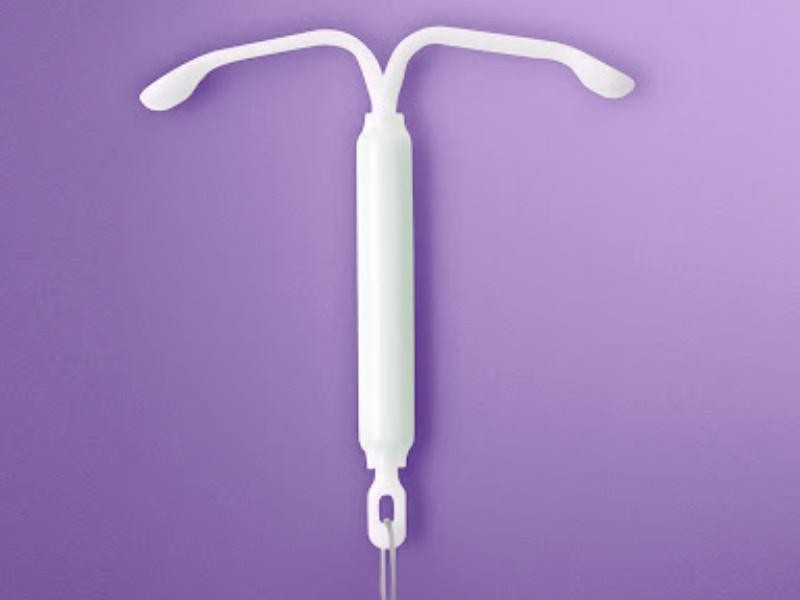 Implante de dispositivo intra-uterino (DIU) hormonal