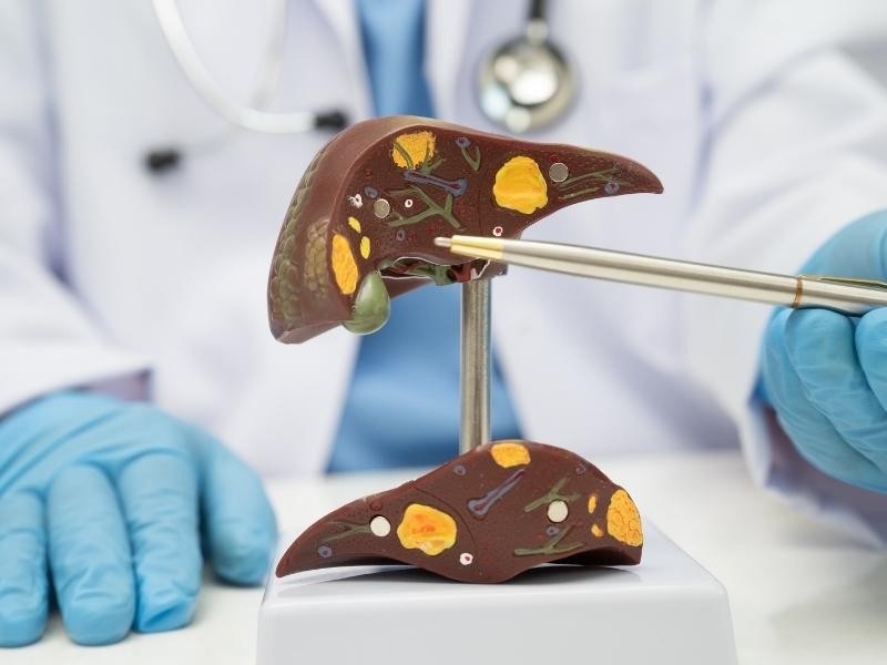 Angioplastia enxerto hepático