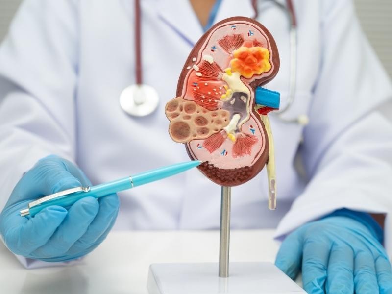 Ablação percutânea de tumor renal