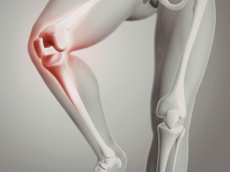 Angioplastia femoral e/ou poplítea