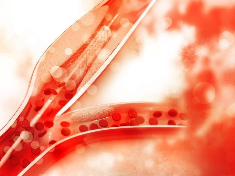 Angioplastia do tronco celíaco