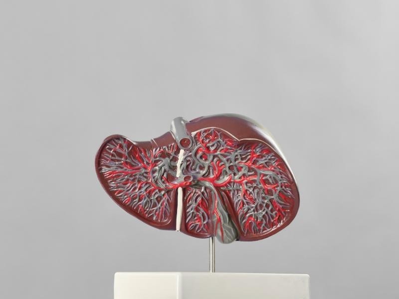 Angioplastia veia porta