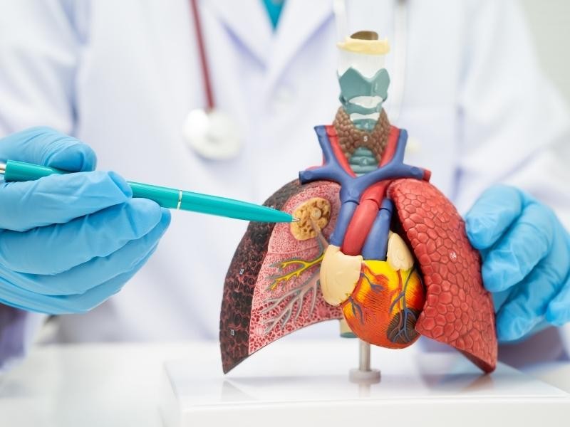 Ablação percutânea de tumor pulmonar