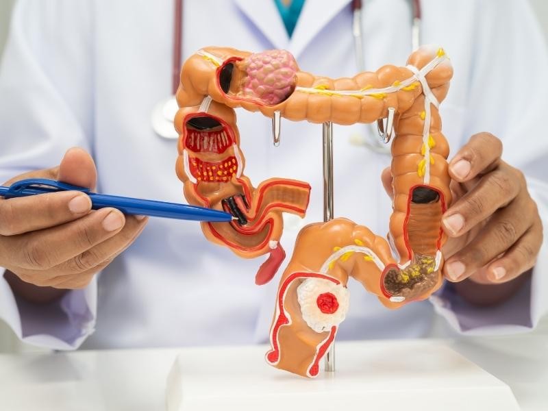 Arteriografia mesentérica