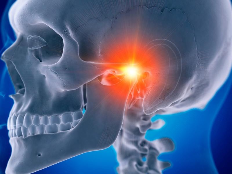 Artroplastia de ATM (articulação temporo-mandibular) fechada