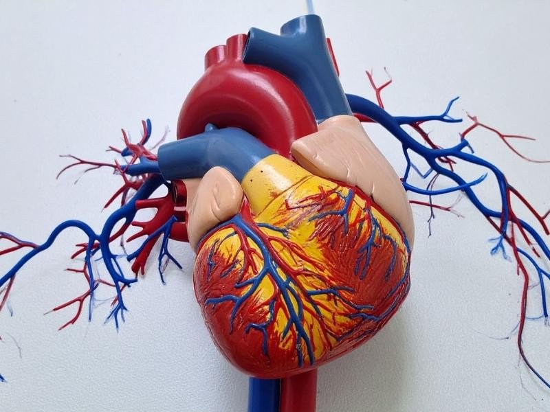 Arteriografia ilíaca