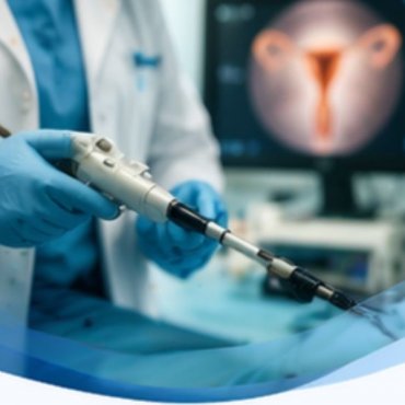 Alcoolização de Endometriomas Ovarianos em Atibaia
