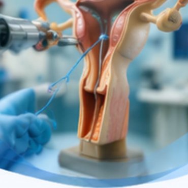 Recanalização de Tubas Uterinas em Atibaia