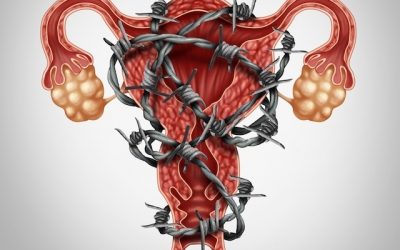 Saiba mais sobre a Endometriose