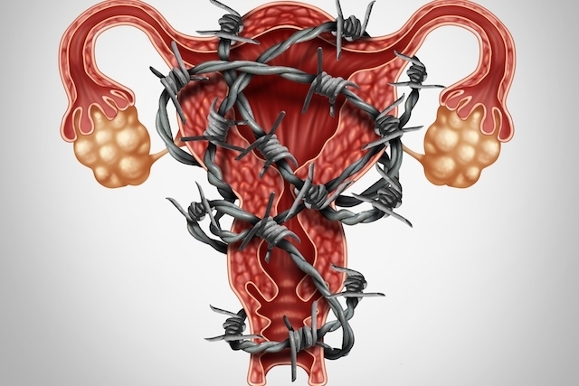 Saiba mais sobre a Endometriose