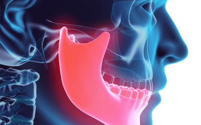 Dor na ATM? Conheça as causas da DTM e seus tratamentos